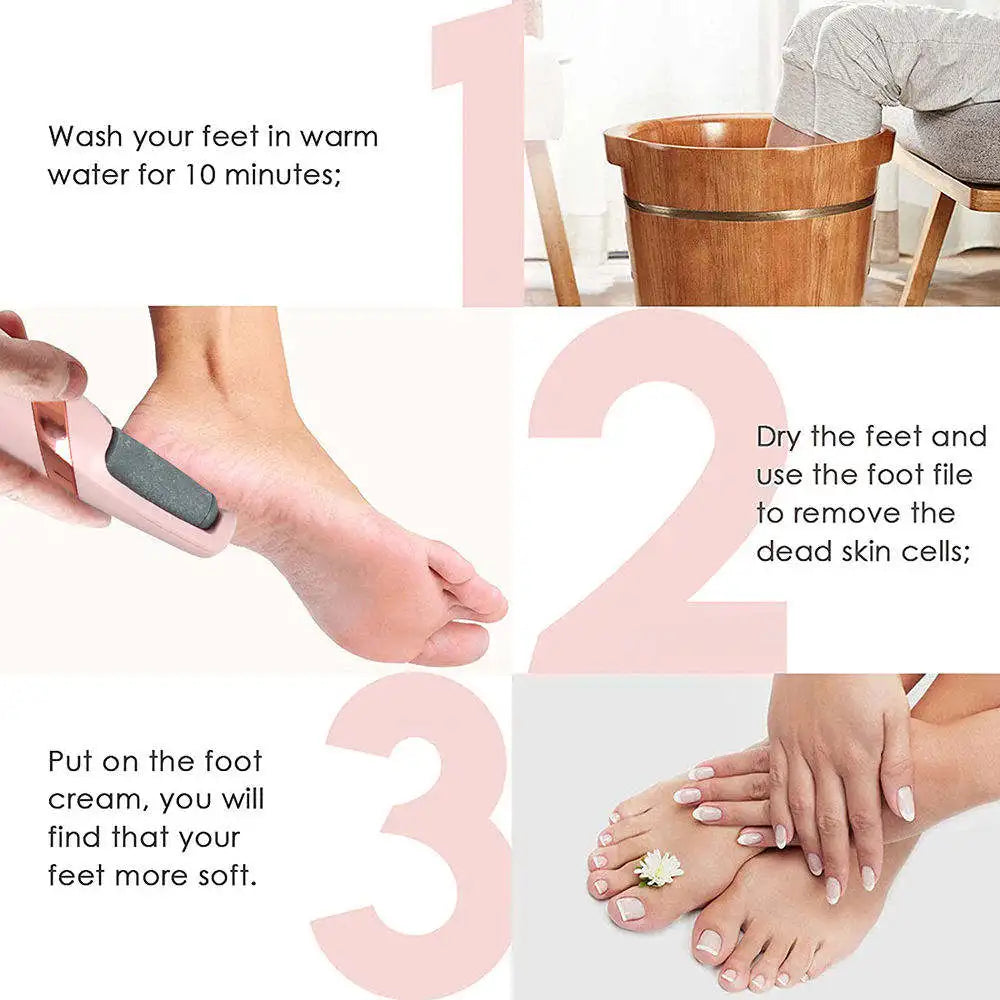 Cordless Electric Callus Remover – Smooth Feet Instantly!