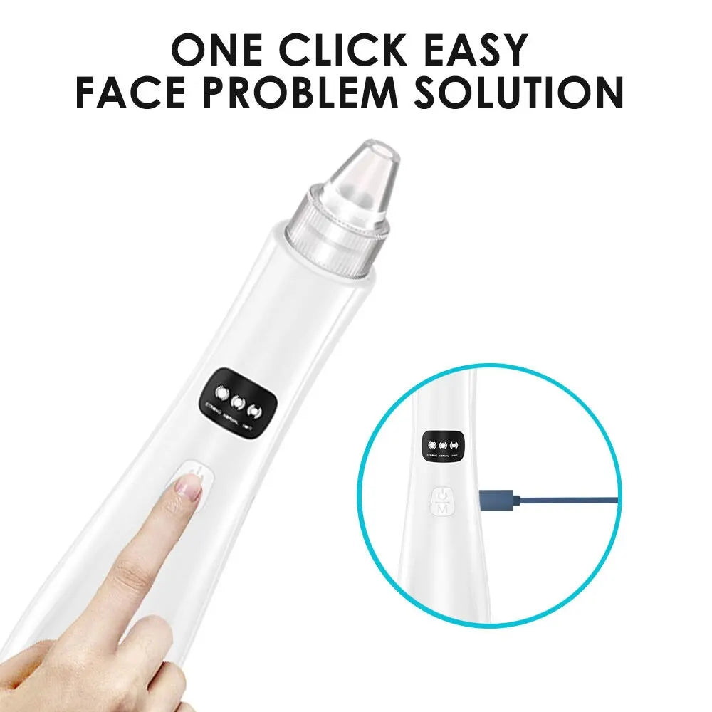 Rechargeable 3-Speed Blackhead Remover