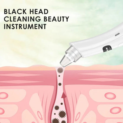 Rechargeable 3-Speed Blackhead Remover