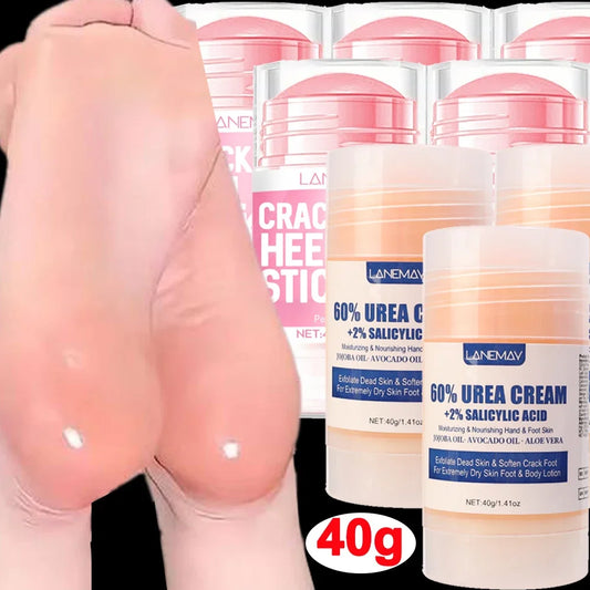 Urea Foot Cream Stick – Heal Cracked Heels & Soften Dry Skin